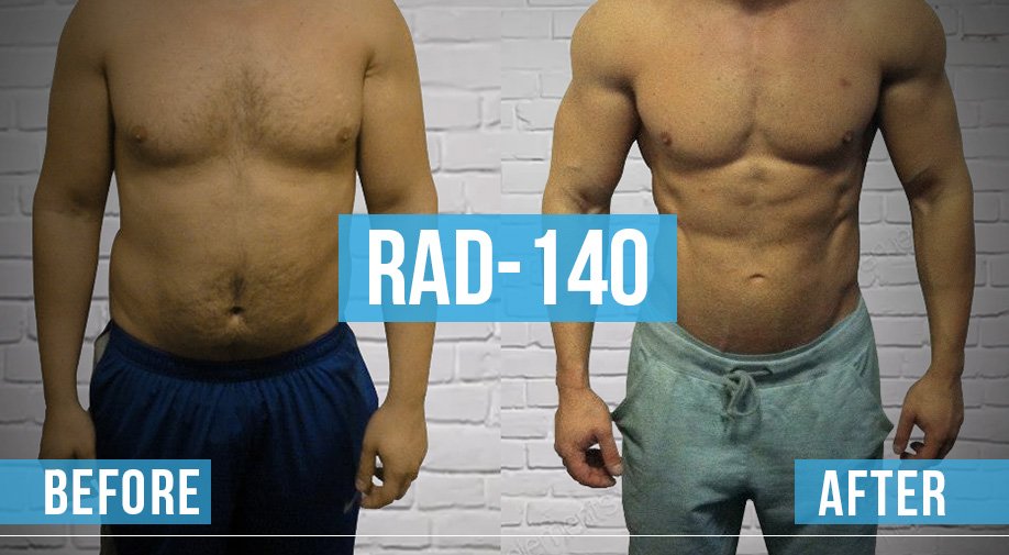 rad-140-before-and-after